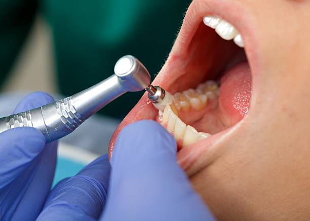 Best Wisdom Tooth Removal  in Rockvale, TN